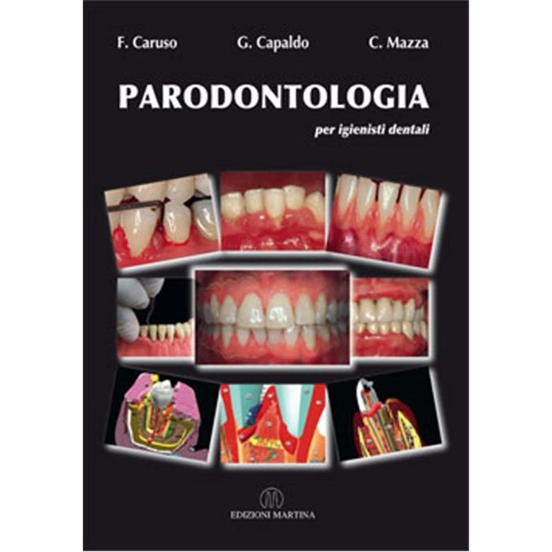 PARODONTOLOGIA per igienisti dentali